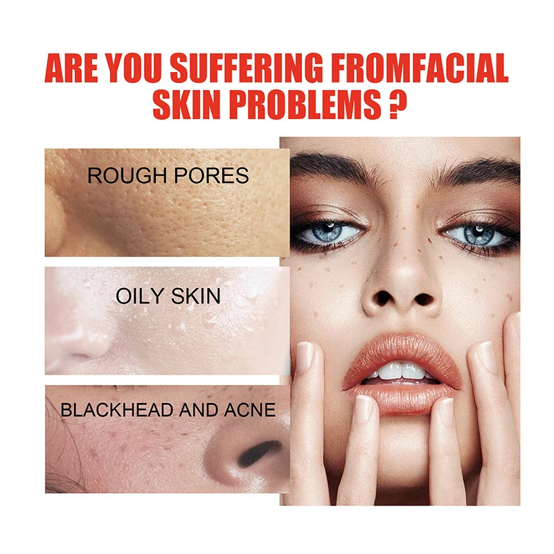 30ml Facial Serum Smooth Skin Oil Control Essence Moisturizing And Lasting Relieve Dry Skin Serum Facial Care Products