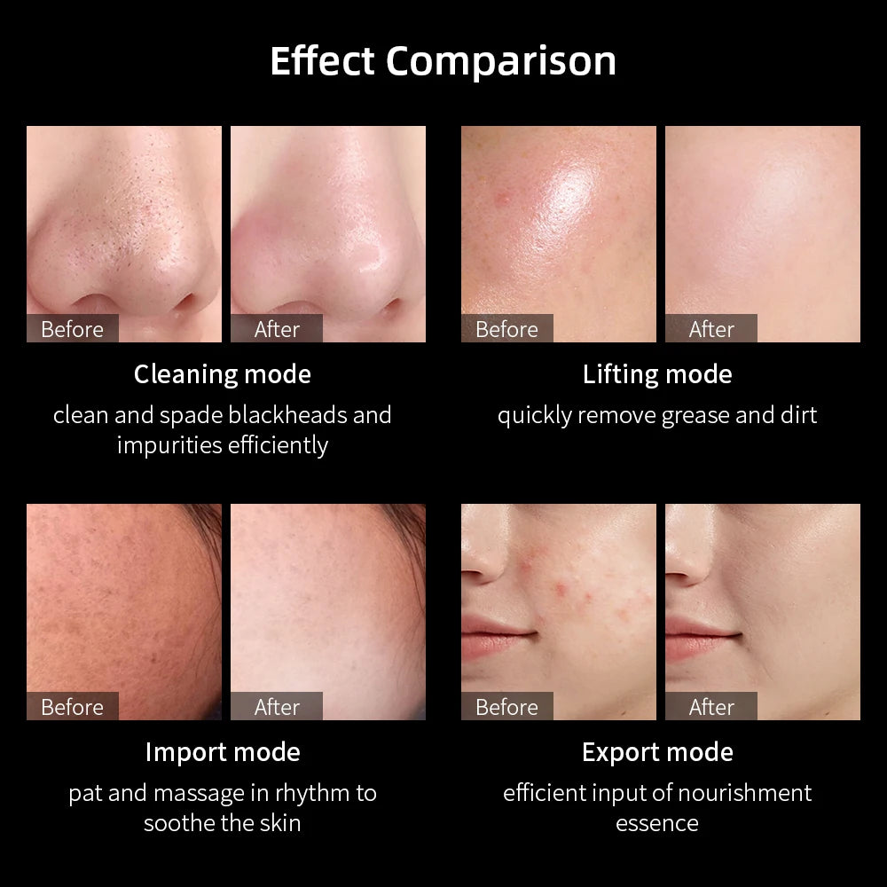 Ultrasonic Skin Scrubber Facial Spatula Blackhead Remover Deep Face Cleaning Lift Machine Peeling Shovel Pore Cleaner
