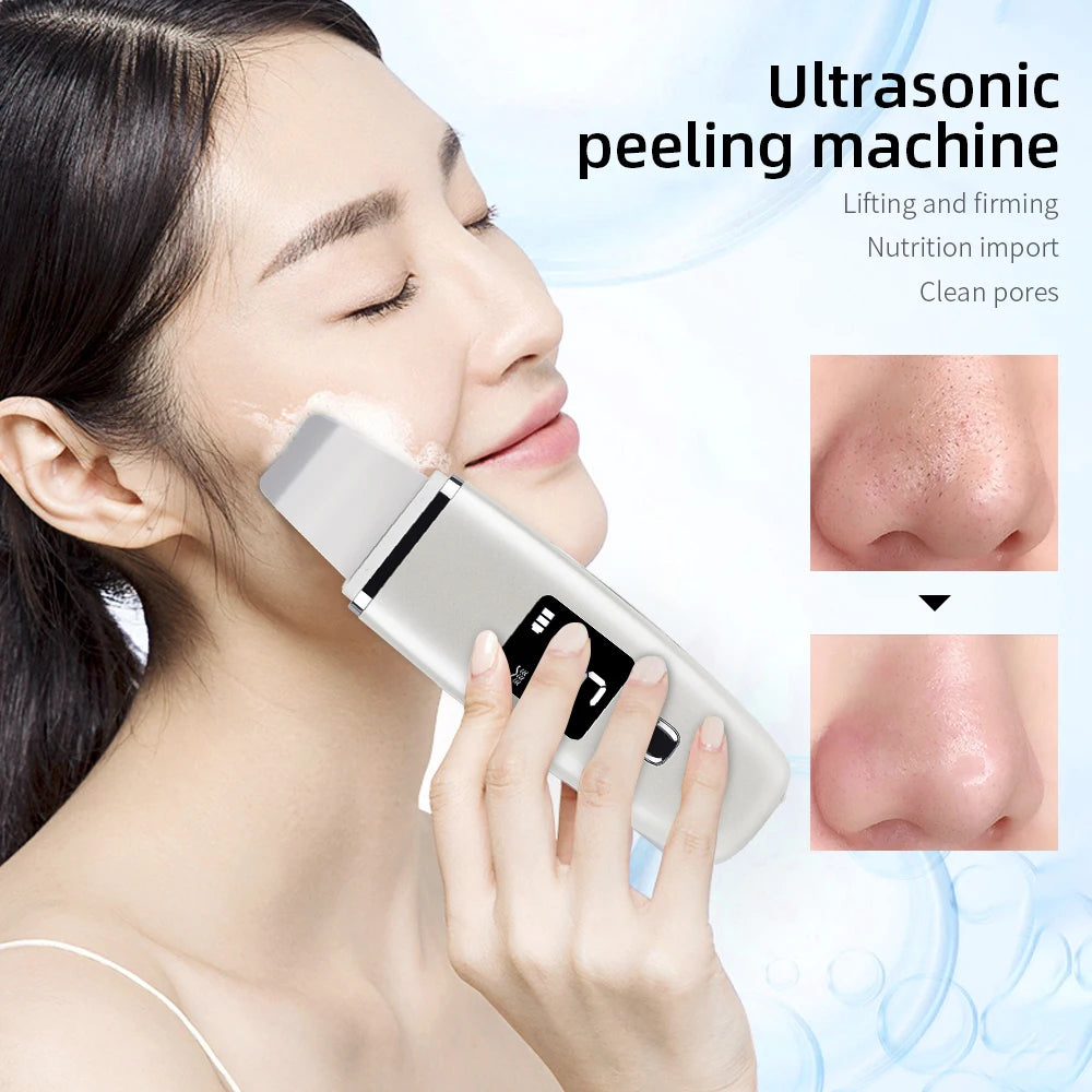 Ultrasonic Skin Scrubber Facial Spatula Blackhead Remover Deep Face Cleaning Lift Machine Peeling Shovel Pore Cleaner